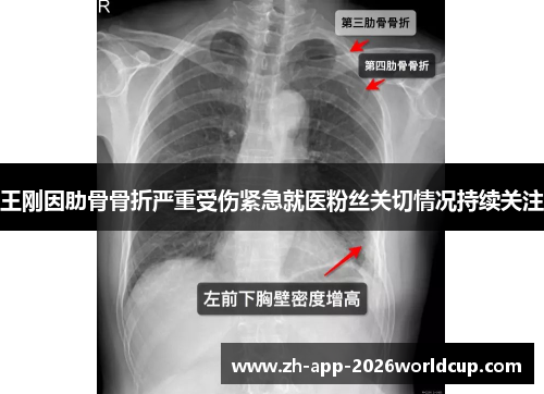 王刚因肋骨骨折严重受伤紧急就医粉丝关切情况持续关注